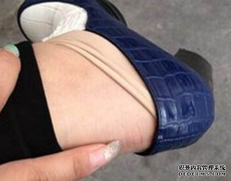 新鞋磨脚跟怎么办 新鞋磨脚跟的处理方法 新鞋磨脚跟怎么办 新鞋磨脚跟的处理方法